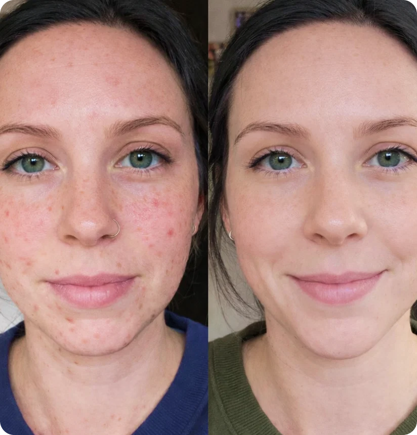 Before and after transformation profile for Sophie, 28